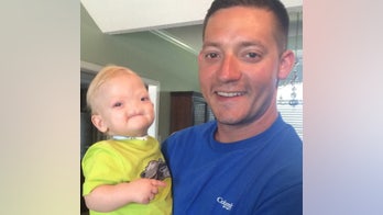 'Miracle baby' born without a nose dies at age 2, family says