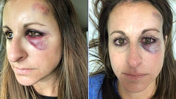 Florida woman hit in face with puck at NHL playoff game