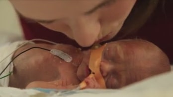 How ‘Finding Nemo’ creator unexpectedly inspired family of preemie