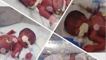 Meet the Fugate Quadruplets