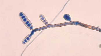 Meningitis outbreak: Should anti-fungal medications be given to those at risk?