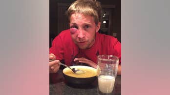 Teen with Asperger’s allegedly beaten by strangers wants suspects to learn from him