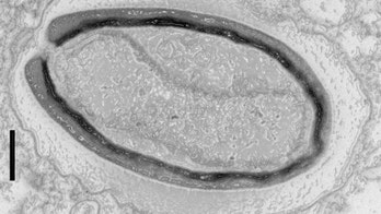 Giant, terrifying viruses invent their own genes