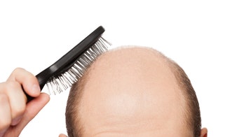 Why you're going bald — and how to get your hair back