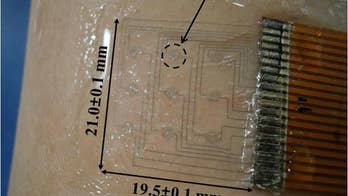 Wearable goose bump sensor may detect some emotions