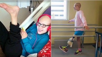 Georgia girl's ankle, foot reattached backward to create new knee after cancer diagnosis