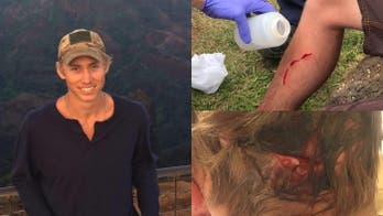 Man bitten by shark, bear, snake in less than 4 years