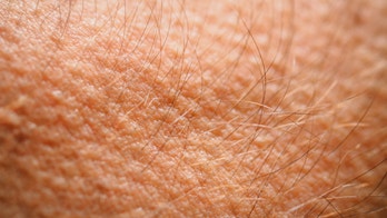 Lab-grown skin sweats and sprouts hair