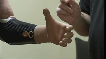 New advancements help amputees return to activities post-injury