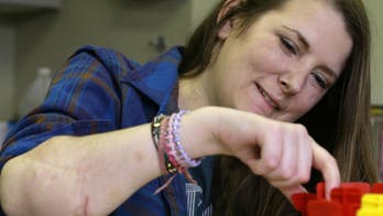 Hand, face transplants to be regulated like other organs