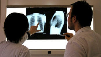 Early x-rays might not help elderly with new back pain