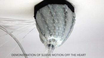 Flabby heart keeps pumping with squeeze from robotic sleeve
