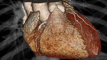 Study calls heart imaging into question for mild chest pain