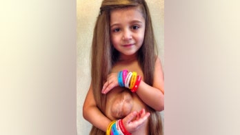 2 girls born with hearts outside bodies meet for playdate
