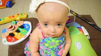 1-year-old battling rare bone disorder dies despite life-saving operation