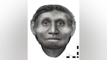 Real-life 'hobbit' face revealed