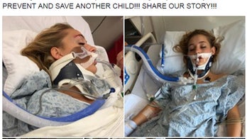 Woman shares chilling photos of daughter to warn against underage drinking