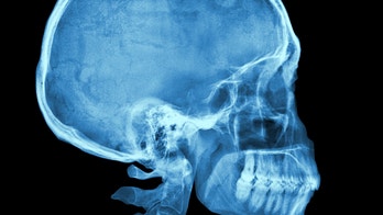 Texas mom urges parents to beware 'soft spot' condition plaguing her 5-month-old