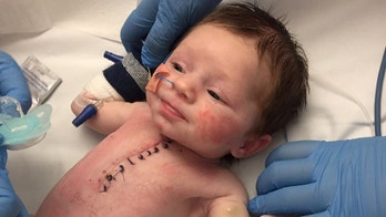 Brave baby survives open-heart surgery at 1-week old