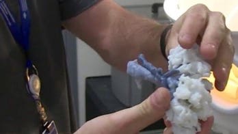 Doctors use 3-D printed kidney to help save woman's organ