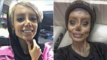 Teenage 'Corpse Bride' admits to faking Instagram photos all along