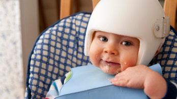 This entire family is wearing helmets in support of baby with flat head syndrome