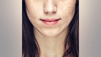 Keloids and nose piercings: What you need to know