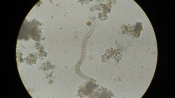 Doctor removes brain-eating tapeworm growing in man's eye