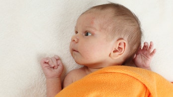 For kids with eczema, 'soak and smear'