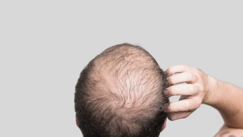 Is the cure for baldness close?