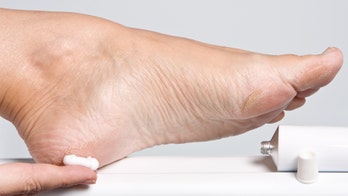 4 embarrassing health problems and how to treat them