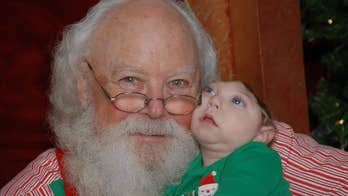 Boy born with partial skull meets Santa, celebrates other childhood milestones