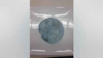 Breast implant or jellyfish? Man brings 'mystery' object to police
