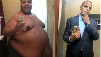 Michigan man fundraising for surgery to remove excess skin after losing 400 pounds