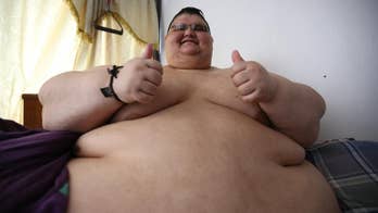 Man who was once world's most obese patient readies for weight-loss surgery