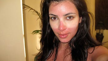 Cover your sunburn this way to make it heal faster