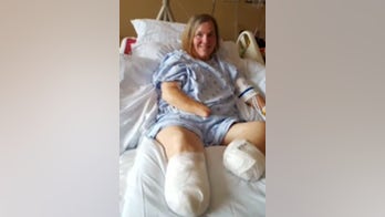 Woman loses both hands, legs after sepsis battle