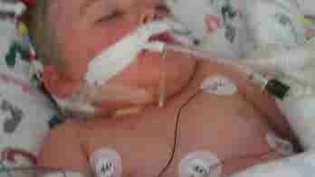 Toddler on life support after contracting E. coli infection