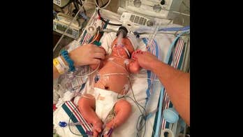 Boy given 5 percent chance of survival marks 1st birthday