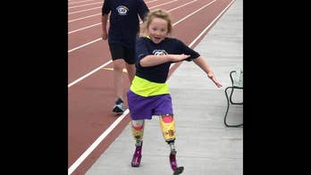 9-year-old fitted with new prosthetics after home is destroyed in California wildfires