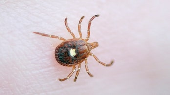 Lone Star tick bites triggering red meat allergies in more people across US, physician says
