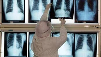 New study casts doubt on lung cancer treatment