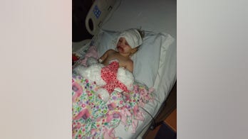 Toddler hospitalized with severe blisters from toy makeup kit making recovery