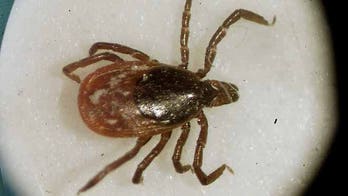 Imperfect test fuels alternative treatments for Lyme disease