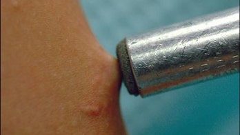 Metal Under the Skin? Find it With a Magnet, Doctors Say