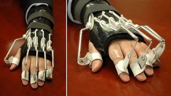 US ambassador using bionic hand to help recover after knife attack