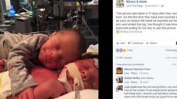 Newborn seen in viral photo hugging twin brother dies of rare disorder