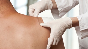 Ibuprofen patch heralds side effect free drug future