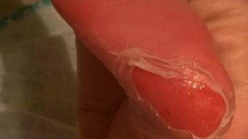 2-week-old baby allegedly suffers second-degree burns at doctor's office