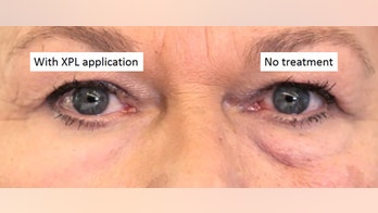 Scientists engineer 'second skin' that corrects wrinkles